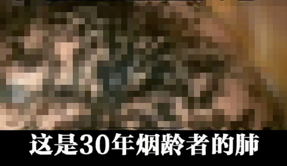 戒烟后，肺部能恢复健康吗？提醒：2种方法自测肺功能，不妨试试